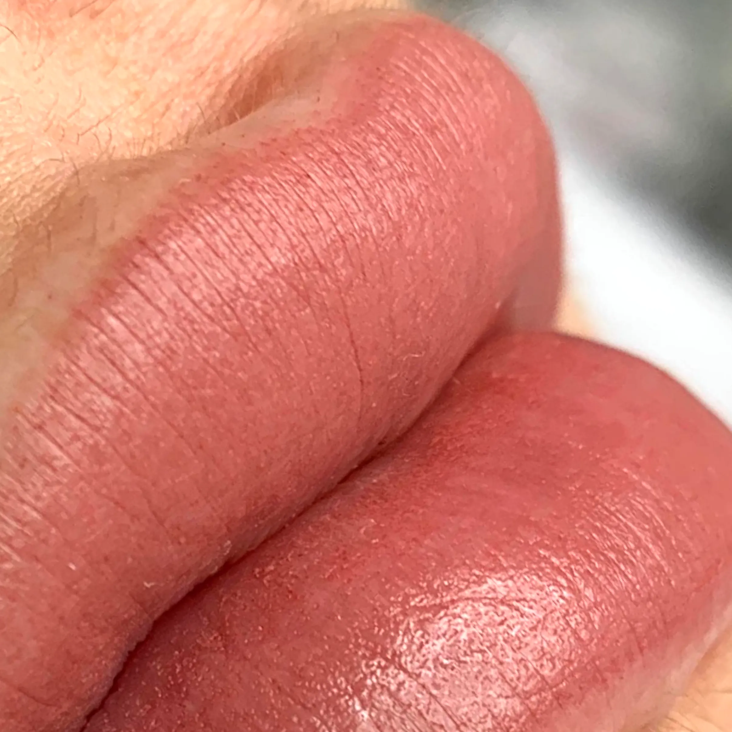 lip neutralisation