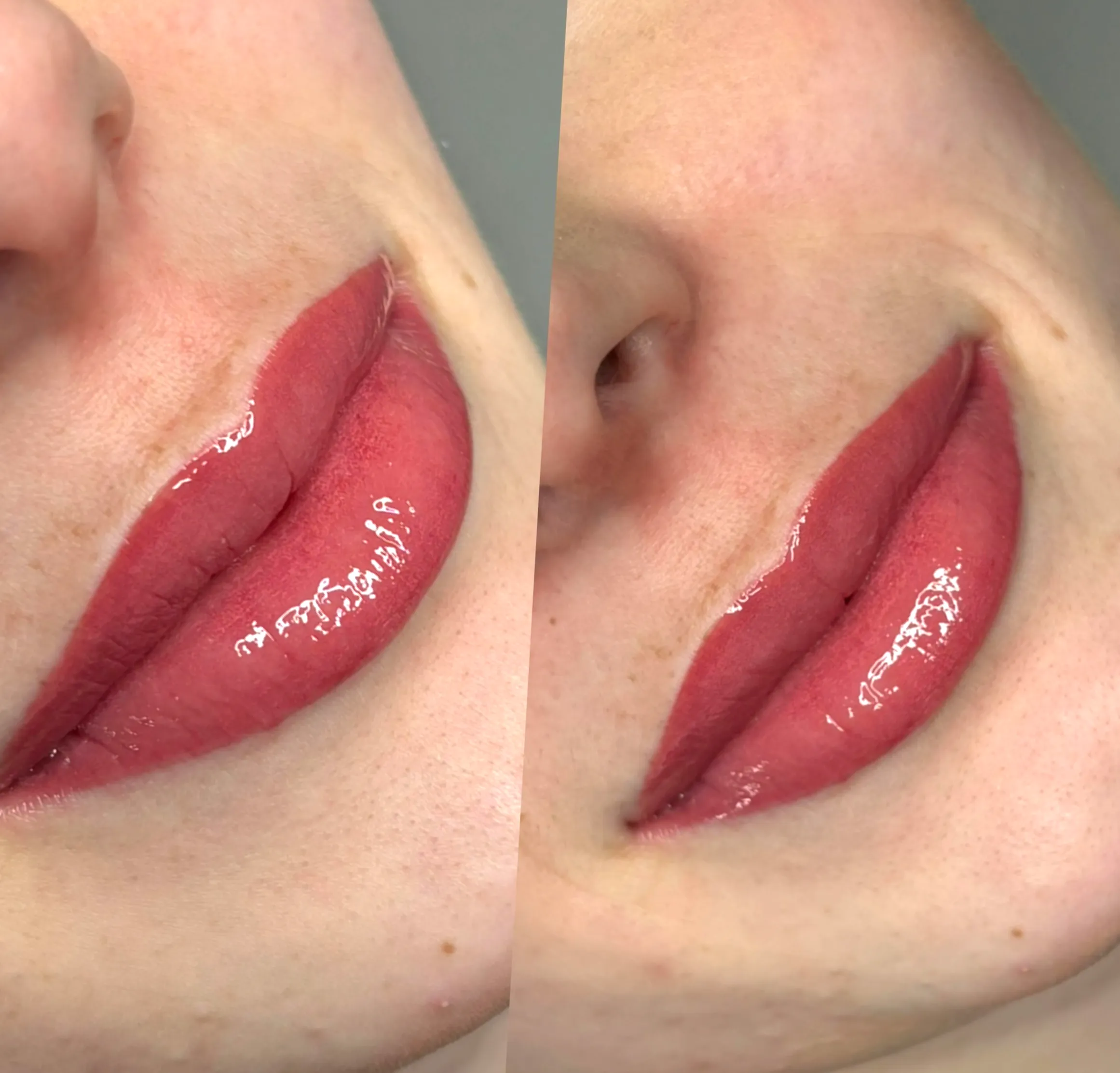 lip lightening home remedies