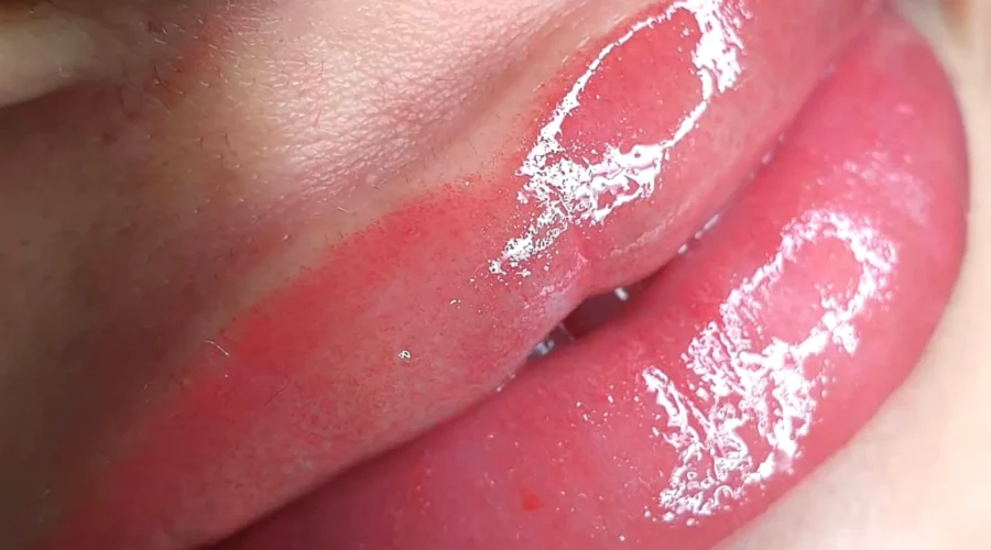 Dark Lips Turning Pink